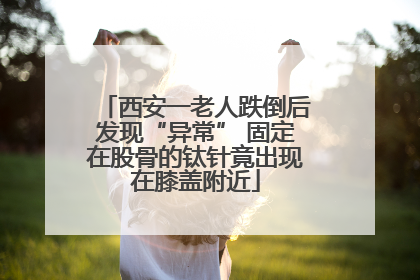 西安一老人跌倒后发现“异常” 固定在股骨的钛针竟出现在膝盖附近